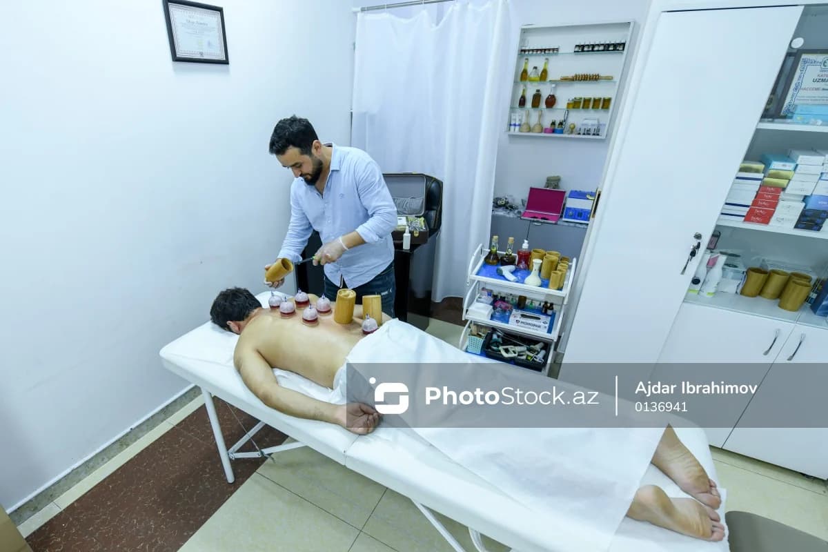 Ənənəvi müalicə üsulu olan hicama prosesi - FOTO