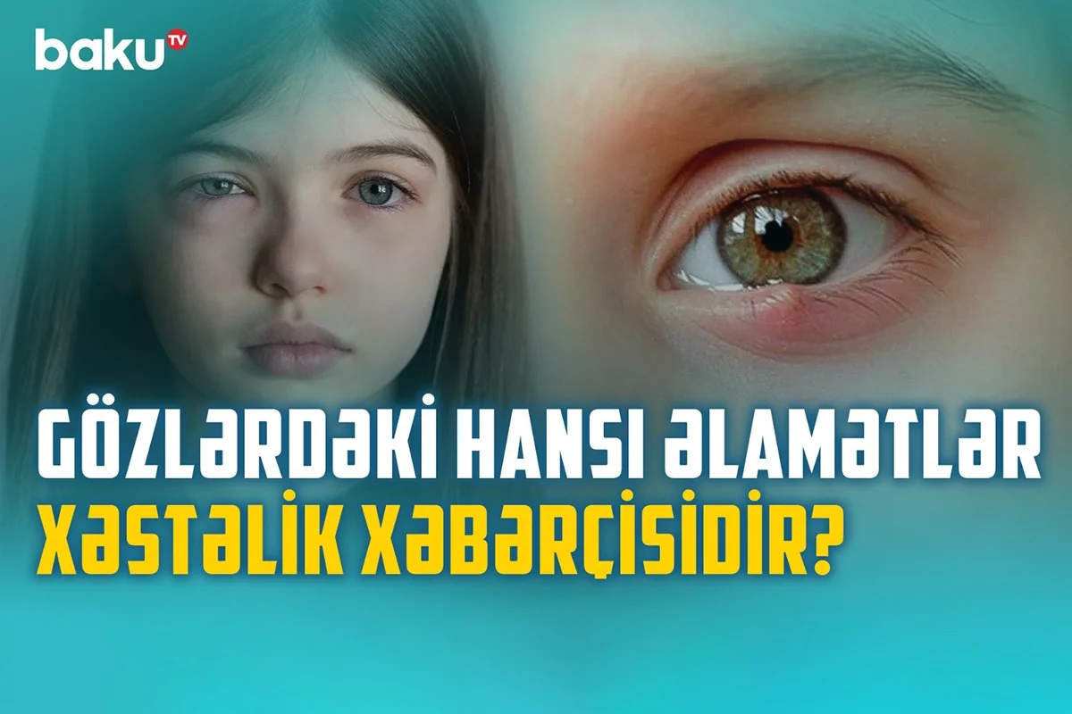 Gözlərimizin zəifləməməsi üçün nə etməli? - VİDEO