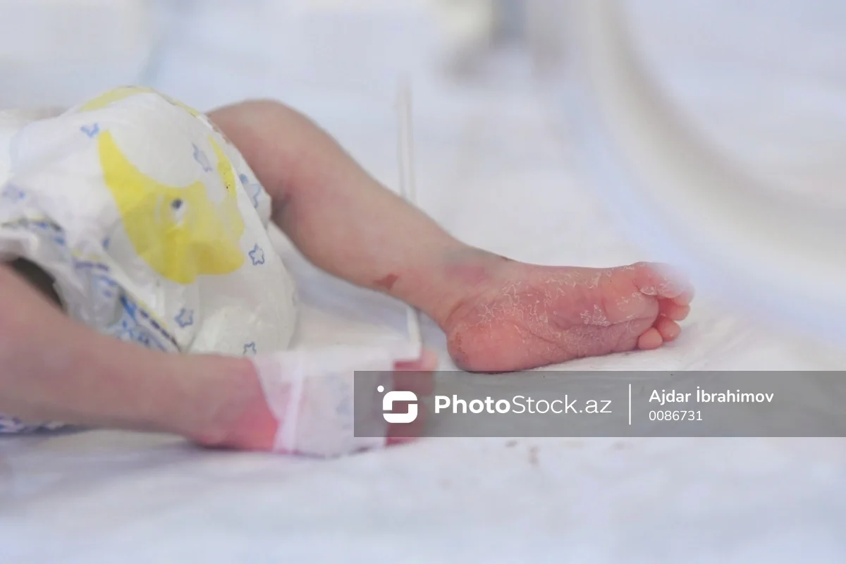 Bakıda bir yaşlı körpə müayinəyə aparıldığı xəstəxanada öldü